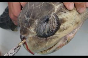 Sea Turtle with Straw up its Nostril - "NO" TO PLASTIC STRAWS
