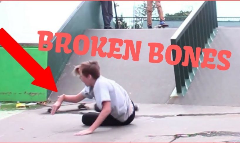 Skateboarding Fails Broken Bones Compilation April 2019