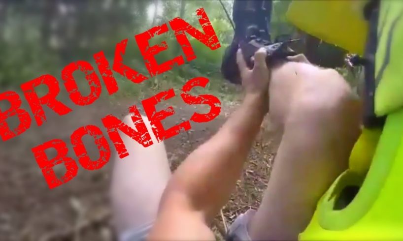 Bad Dirt Bike Crashes and Broken Bones | [S3,Ep.5]