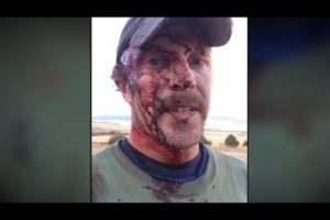 Man takes grizzly attack selfie