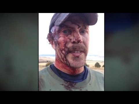 Man takes grizzly attack selfie