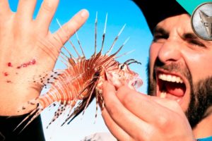 STUNG by a LIONFISH!