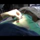 Animal Care Up-Close: Rescued Sea Lion Eye Surgery | SeaWorld San Diego