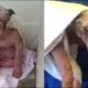 Rescue Puppy Who Was In Immense Pain, with Bleeding Legs, Inflamed Skin and Potential Infections