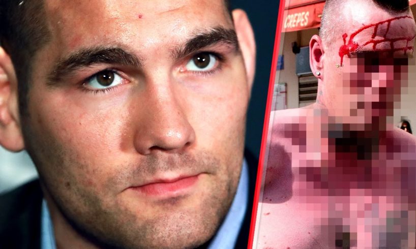 Chris Weidman Recounts Street Fight vs. Three Guys!