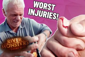 The WORST Injuries! (Part 1) | COMPILATION | River Monsters