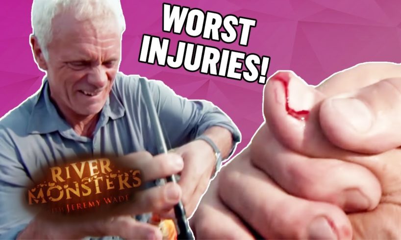 The WORST Injuries! (Part 1) | COMPILATION | River Monsters