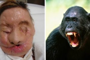 10 Animal Pets That Attacked Their Owner!