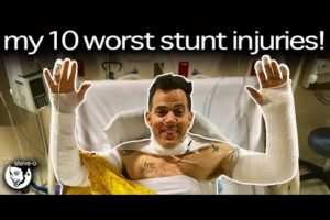 My Ten Worst Stunt Injuries | Steve-O