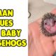 Woman Rescues Abandoned Baby Hedgehogs