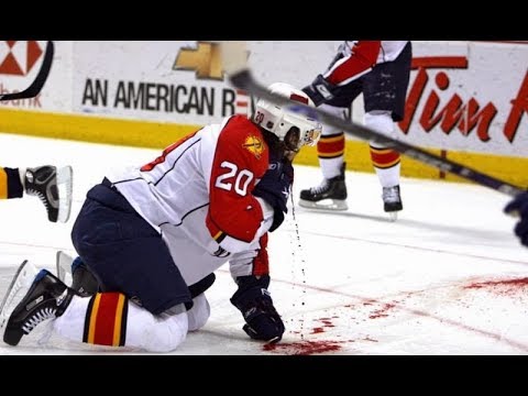 Try Not To Look Away Challenge! Worst NHL Injuries
