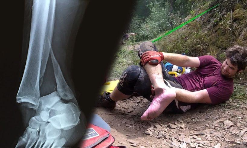 Broke My Ankle Downhill Mountain Biking (Graphic)