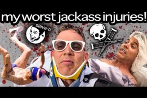 My Most Serious Jackass Injuries | Steve-O