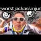 My Most Serious Jackass Injuries | Steve-O