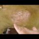 Removing Monster Ticks From Helpless Dog ! Animal Rescue Video 2022 #24