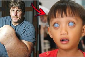 10 Amazing & Unique People Who Shock The World