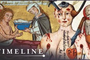 What Diseases Were The Deadliest Of The Middle Ages? | Medieval Dead | Timeline