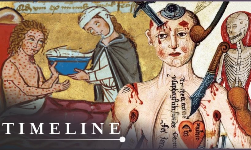 What Diseases Were The Deadliest Of The Middle Ages? | Medieval Dead | Timeline