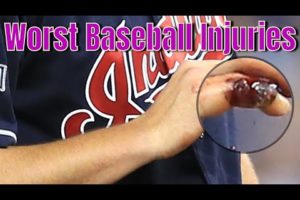 Worst Baseball Injuries 9