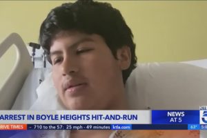Arrest made in hit-and-run that severed teen boy's leg