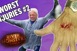 The WORST Injuries! (Part 2) | COMPILATION | River Monsters