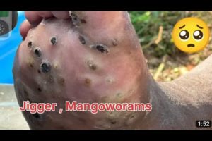 jigger removal man mangoworams removal in dog Animal rescue