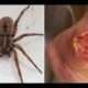 10 most venomous animals in the world