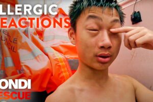 The Scariest Allergic Reactions on Bondi Rescue