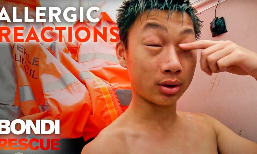 The Scariest Allergic Reactions on Bondi Rescue