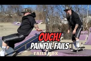 Broken Bones & PAINFUL Fails : Fails Compilation!!