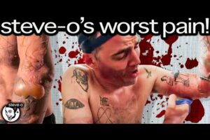 The Horrific Details Of My Most Painful Injury Ever | Steve-O