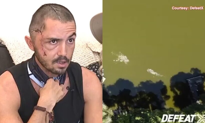 Florida man who survived alligator attack caught on drone video: 'I shouldn't be alive' | ABC7