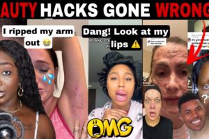 MERCY!😱 BEAUTY HACKS GONE WRONG! COSMETIC TRAUMA DIY BEAUTY FAILS | TIK TOK COMP