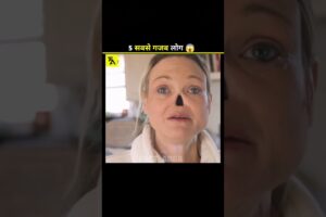 5 ऐसे लोग जिन्हें देखकर चौंक जाओगे 😱 || #shorts #viralvideo