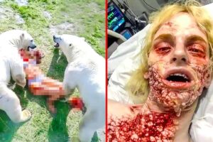 8 Luckiest People Who Survived The Impossible