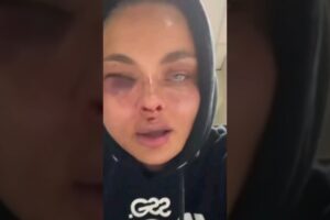 Women after fight Fame MMA "Beautiful yet brutal MMA fight." #shorts #ufc #zusje