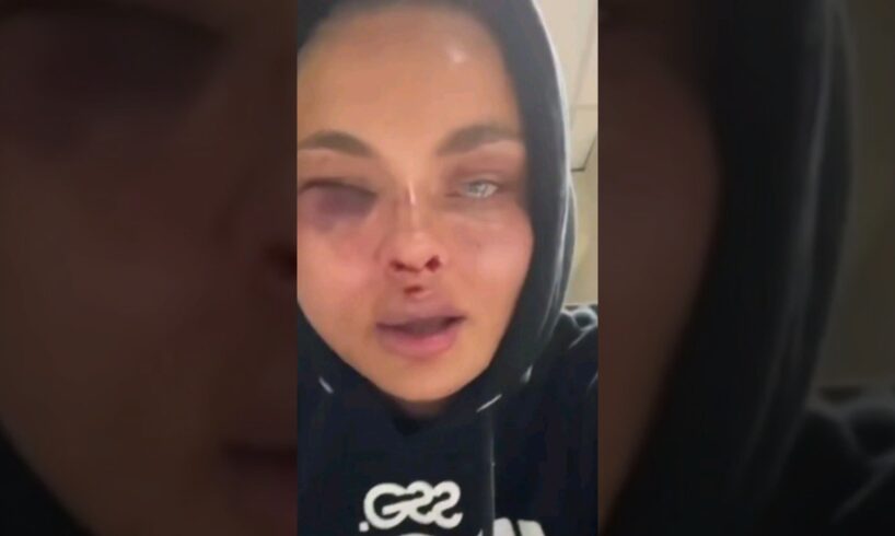 Women after fight Fame MMA "Beautiful yet brutal MMA fight." #shorts #ufc #zusje