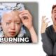 Hairdresser Reacts To Chemical Burn Bleach Fails!