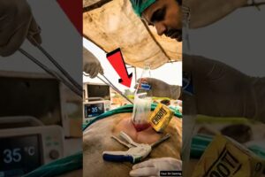 अजगर के पेट में फंसा 700 प्लास्टिक Bottels 😭 | Pythen Rescue Video | #shorts #animalrescue #animals