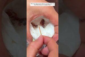 Poor egg #birds #egg #animals #wildliferescue #lovestory #rescue #adoption #pets #wildlife #shorts