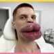 TRY NOT TO LAUGH 😝 Best Funny Fails of the Week (2026 Edition)😂😁😝 Part 31