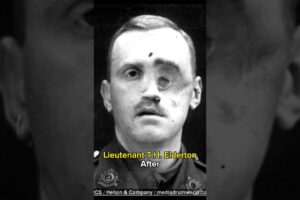 people before and after War #shorts #2023 #history #war #ww2 #pain #army #military #force #death